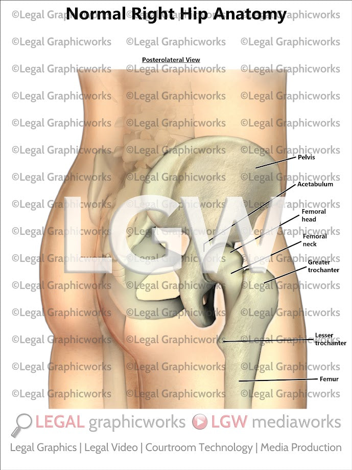 Normal Right Hip Anatomy
