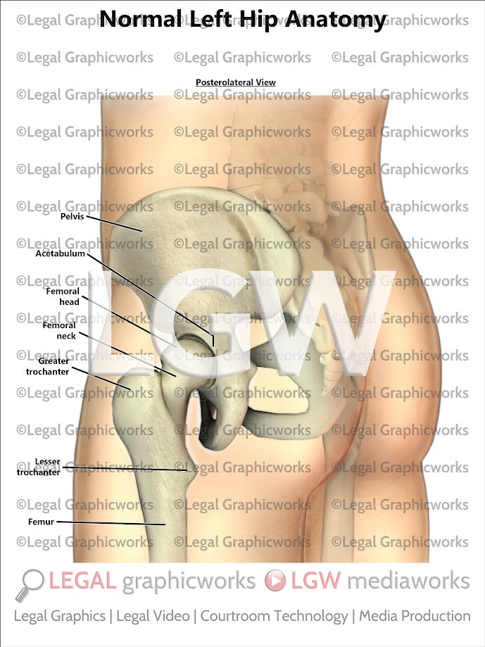 Normal Left Hip Anatomy