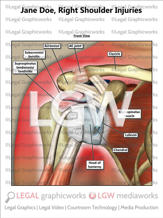 Right Shoulder Injuries
