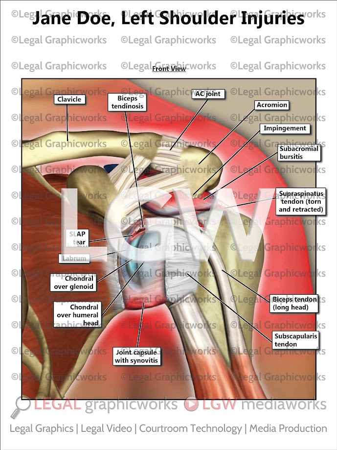 Left Shoulder Injuries