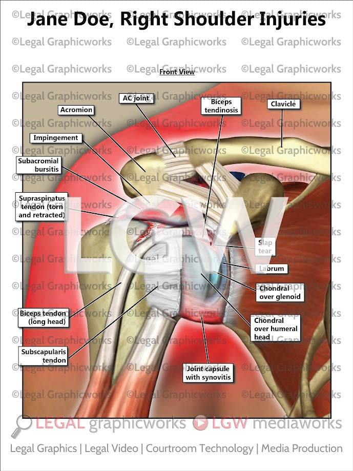 Right Shoulder Injuries