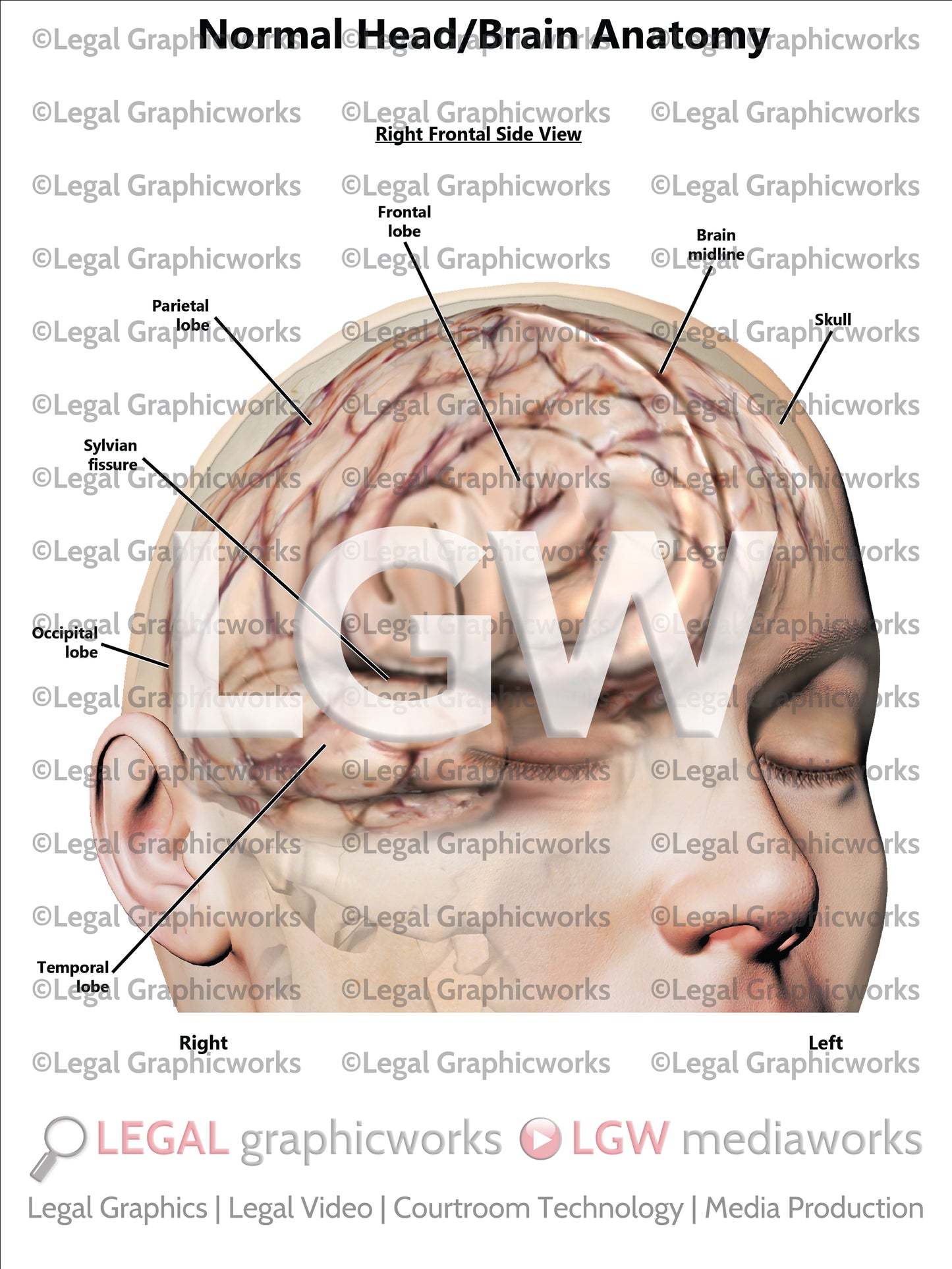 Normal Head/Brain Anatomy