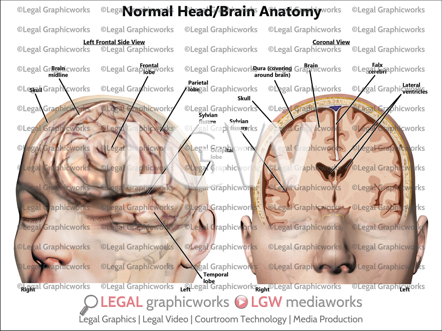 Normal Head/Brain Anatomy