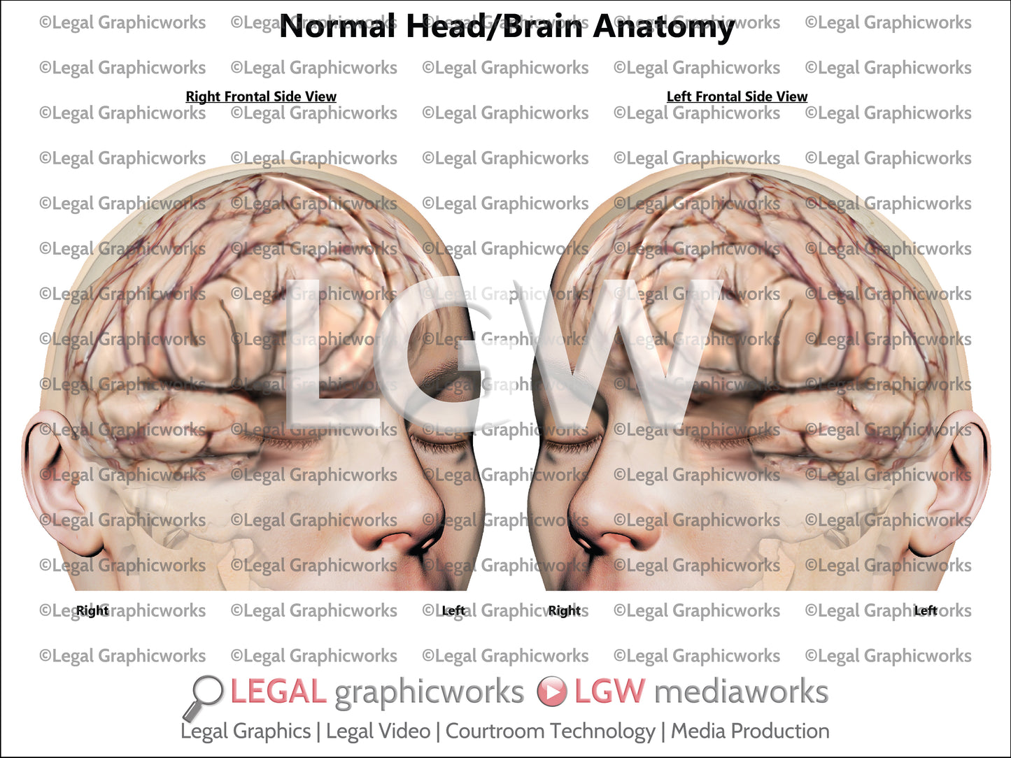 Normal Head/Brain Anatomy