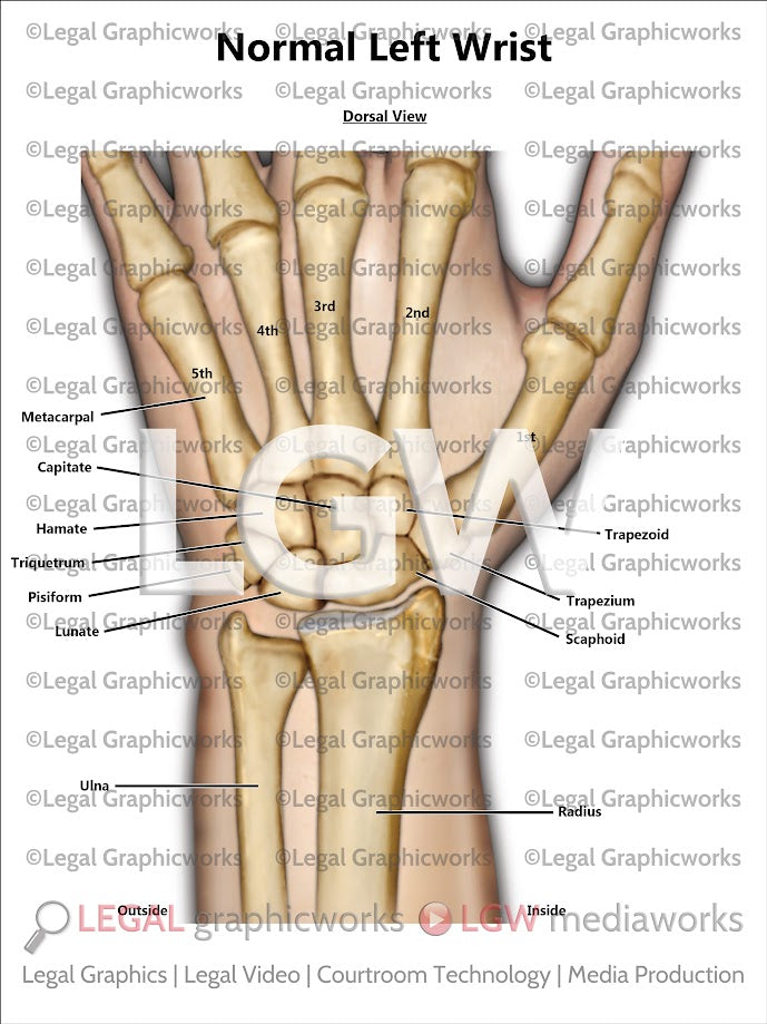 Normal Left Wrist