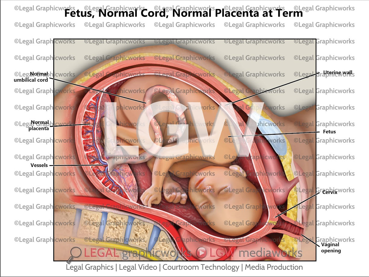 Fetus, Normal Cord, Normal Placenta at Term