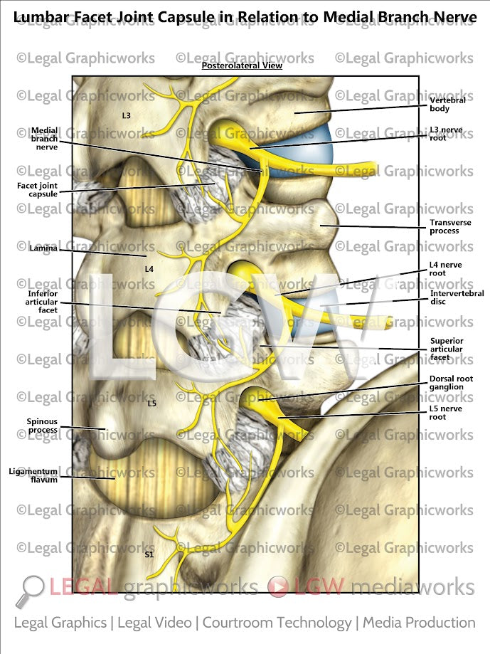 Lumbar Facet Joint Capsule in Relation to Medial Branch Nerve