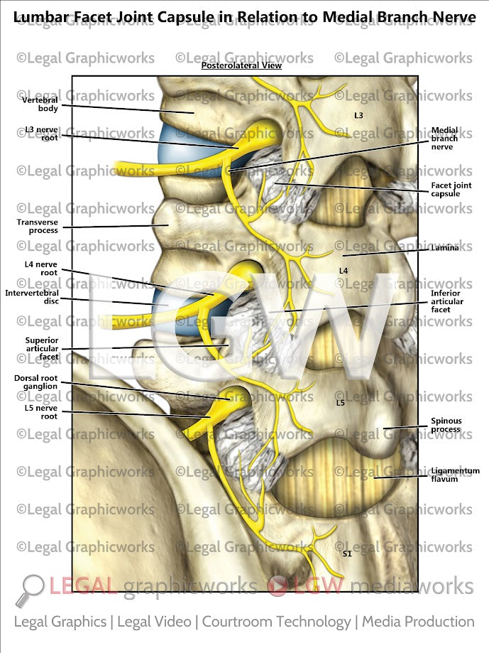 Lumbar Facet Joint Capsule in Relation to Medial Branch Nerve