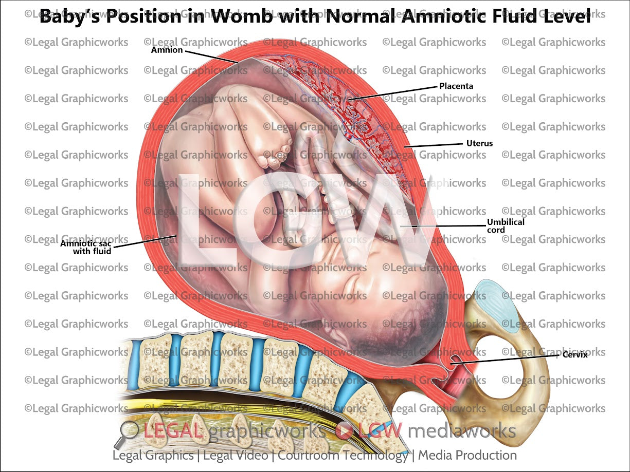 Baby's Position in Womb with Normal Amniotic Fluid Level