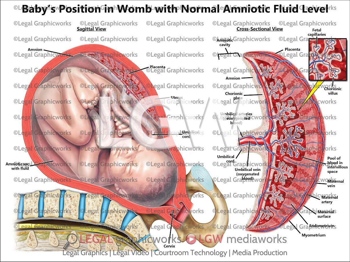 Baby's Position in Womb with Normal Amniotic Fluid Level