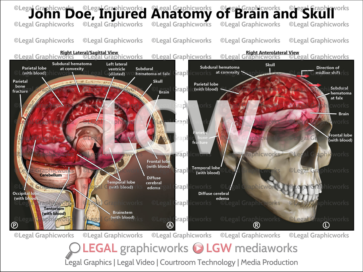 Injured Anatomy of Brain and Skull