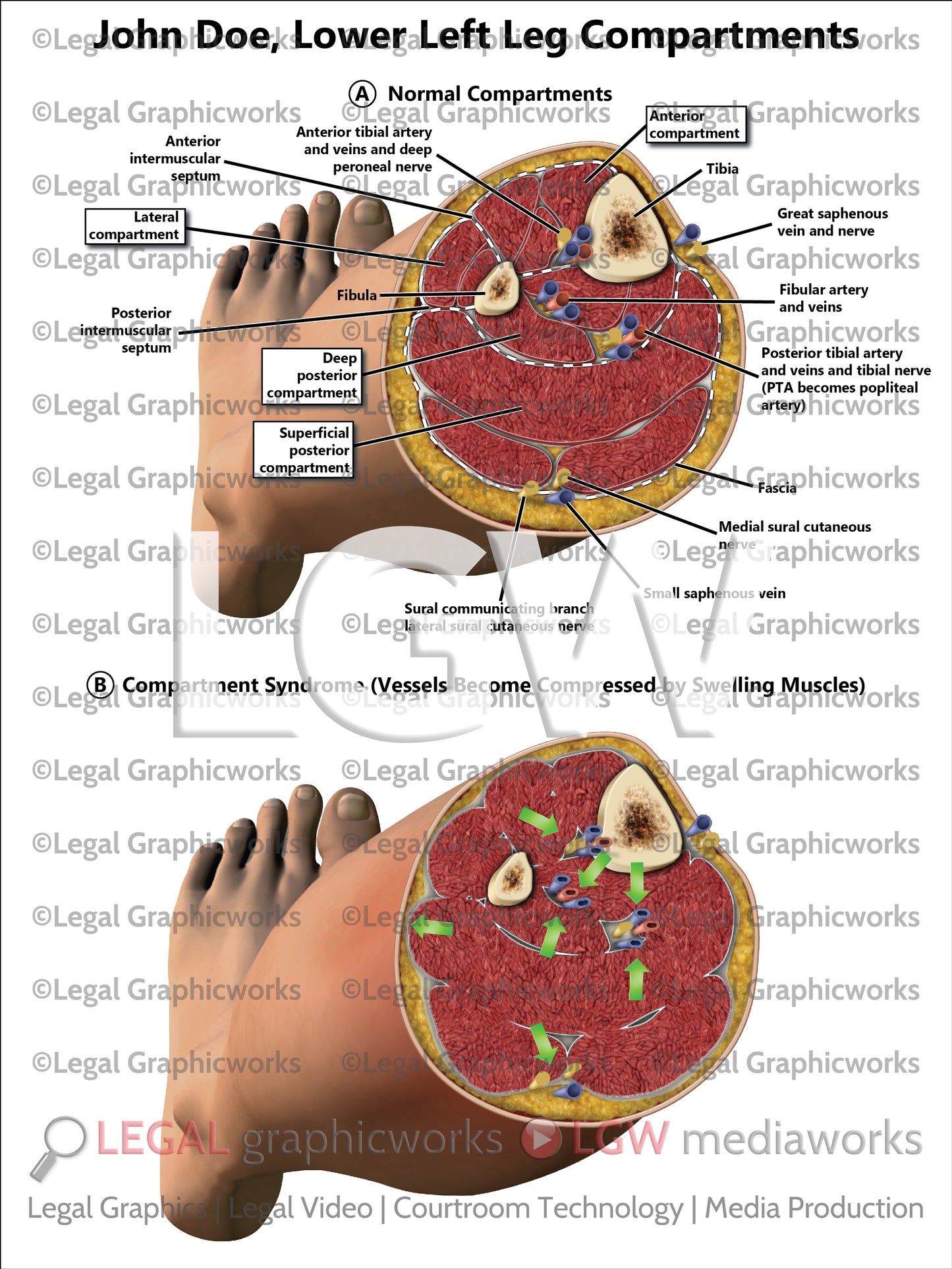 Lower Left Leg Compartments