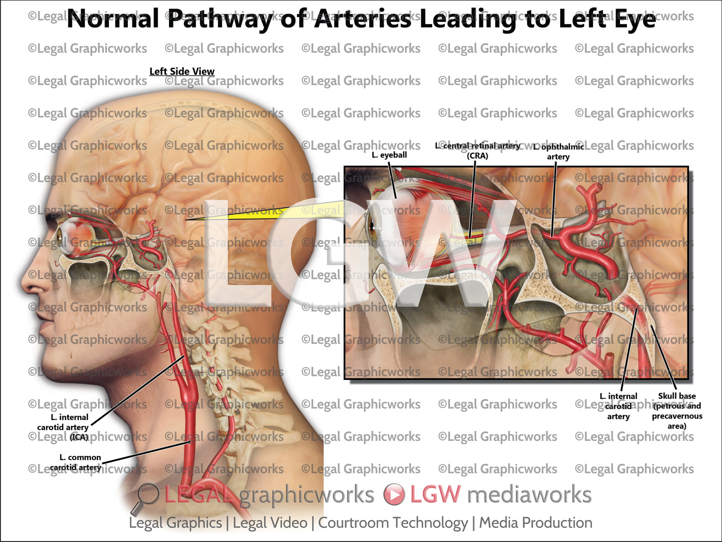 Normal Pathway of Arteries Leading to Left Eye