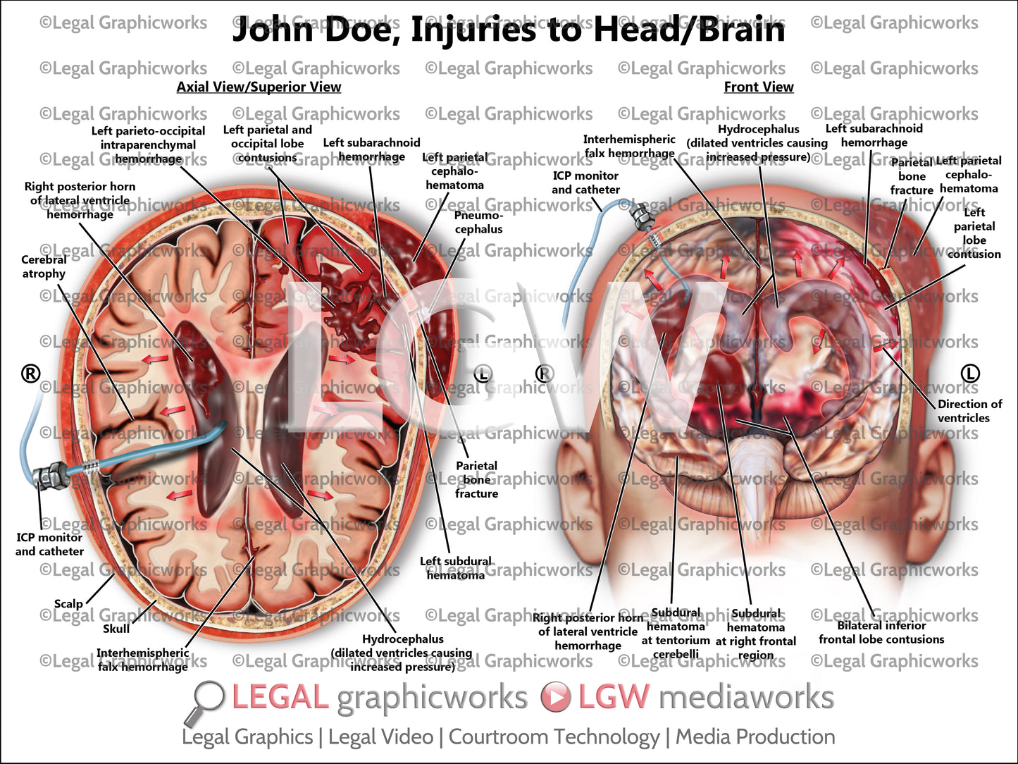 Injuries to Head/Brain