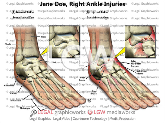 Right Ankle Injuries