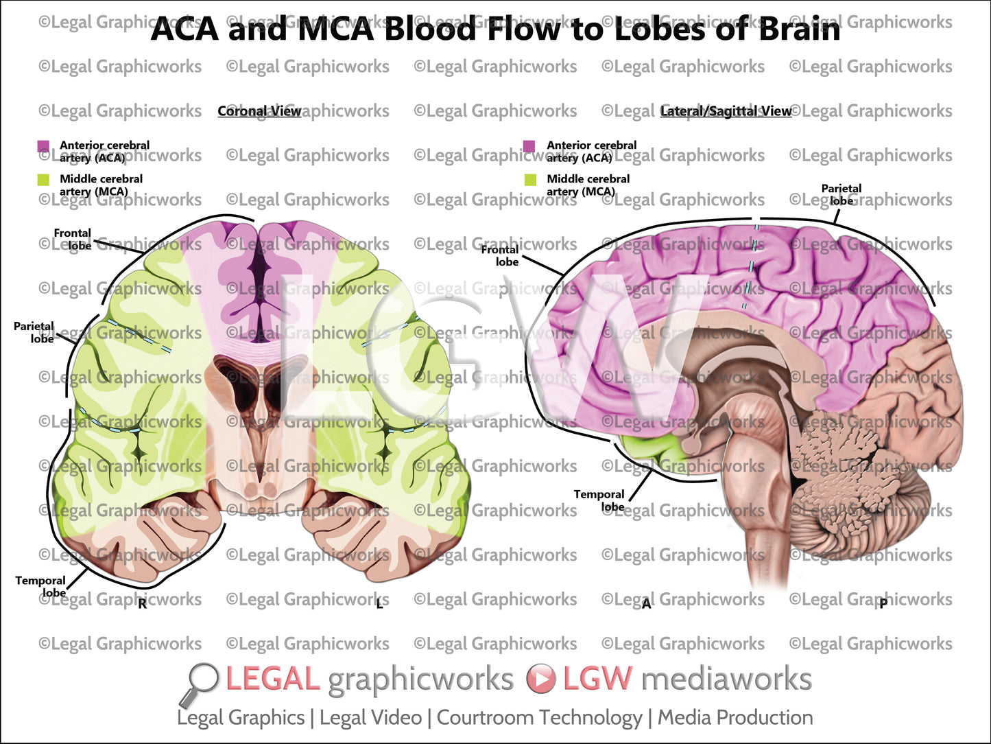 ACA and MCA Blood Flow to Lobes of Brain