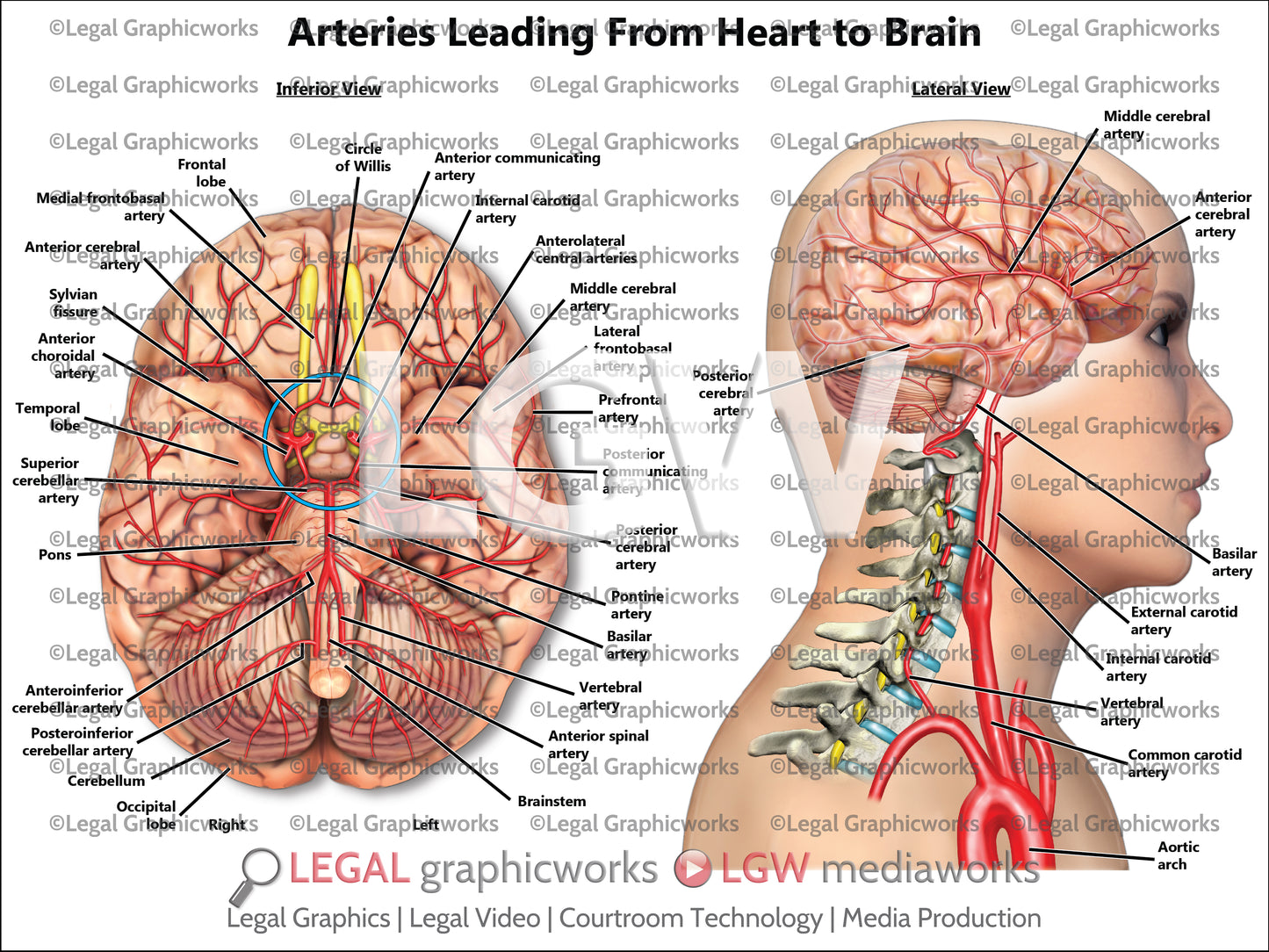 Arteries Leading From Heart to Brain