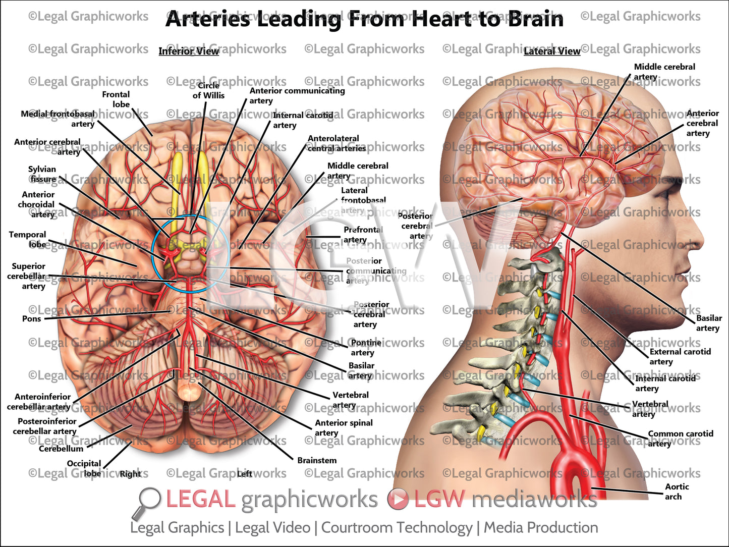 Arteries Leading From Heart to Brain