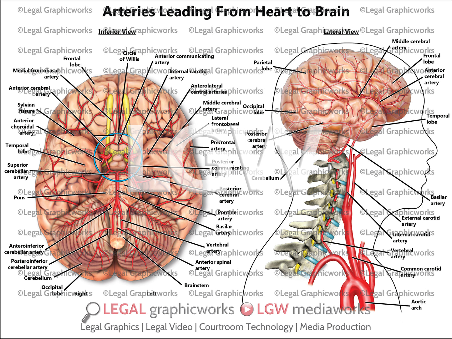 Arteries Leading From Heart to Brain