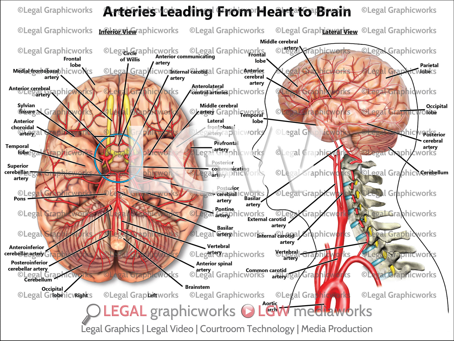 Arteries Leading From Heart to Brain