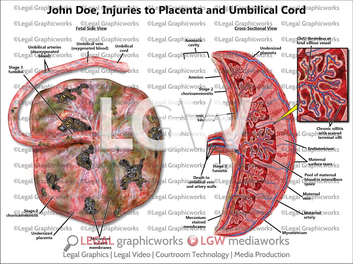 Injuries to Placenta and Umbilical Cord