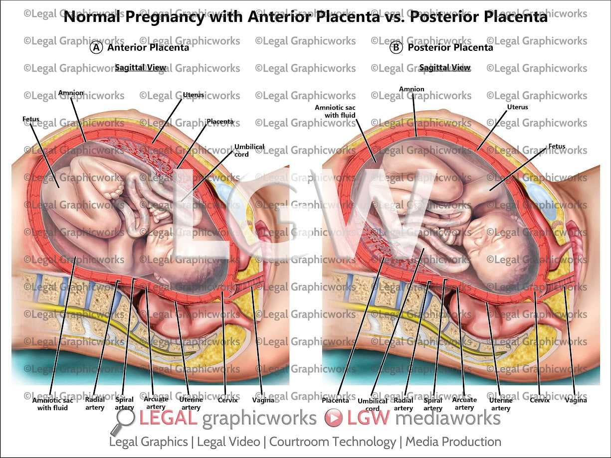 Normal Pregnancy with Anterior Placenta vs. Posterior Placenta