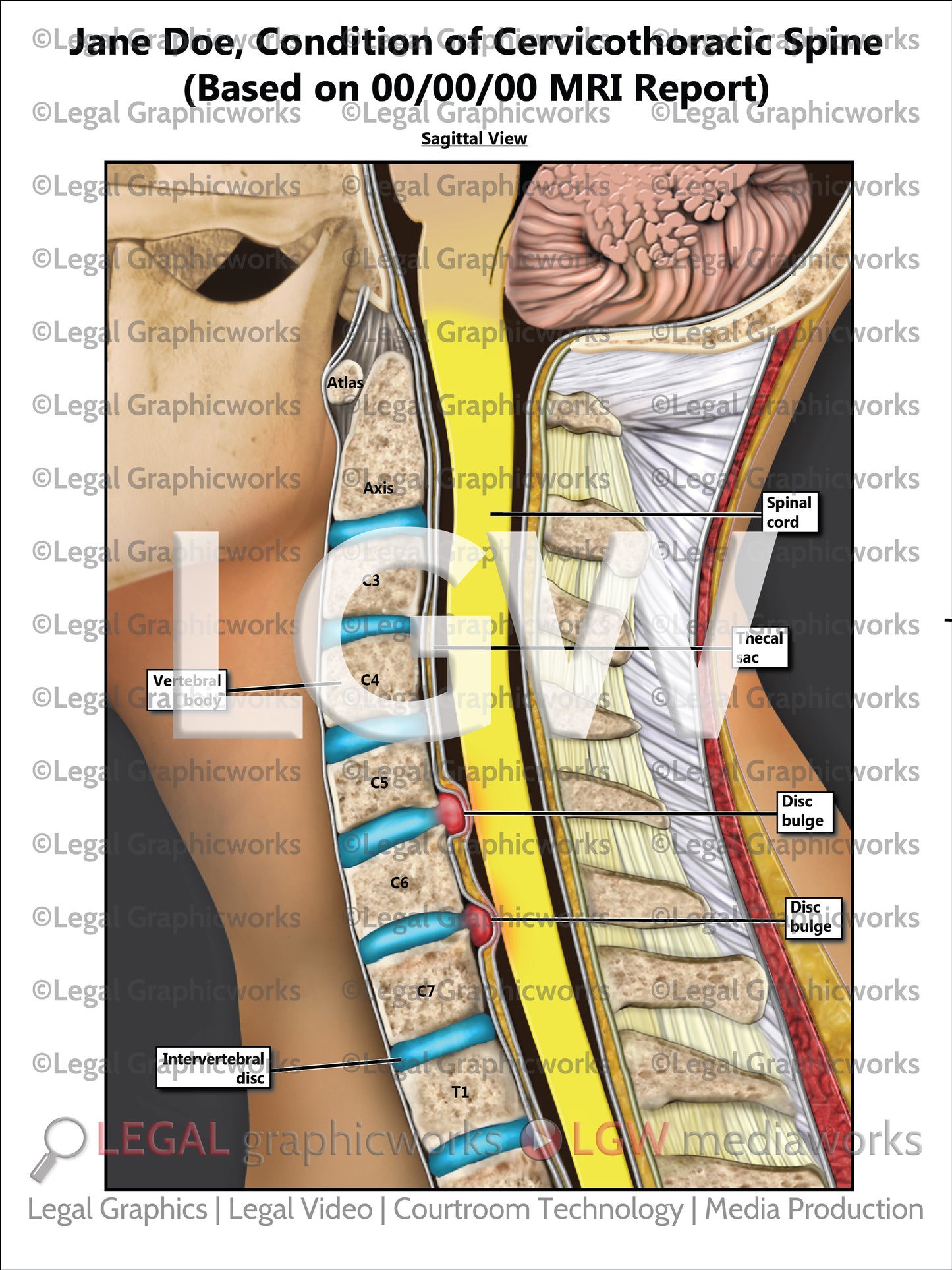 Condition of Cervicothoracic Spine