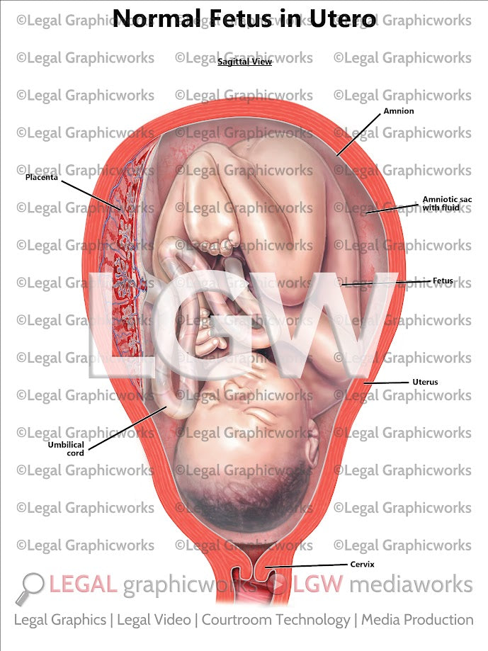 Normal Fetus in Utero