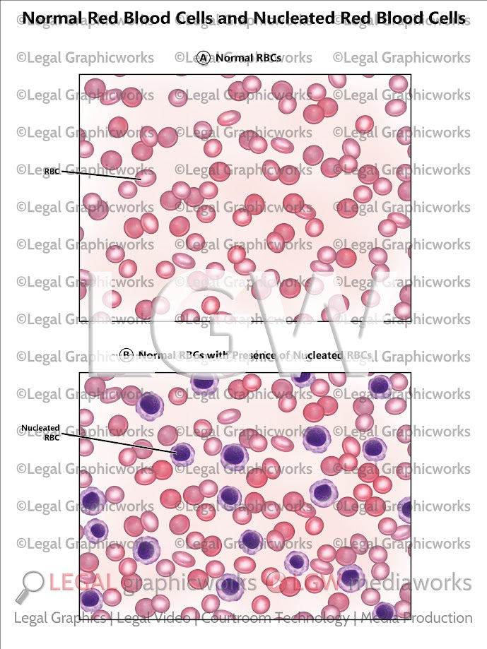 Normal Red Blood Cells and Nucleated Red Blood Cells