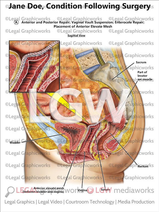 Condition Following Surgery