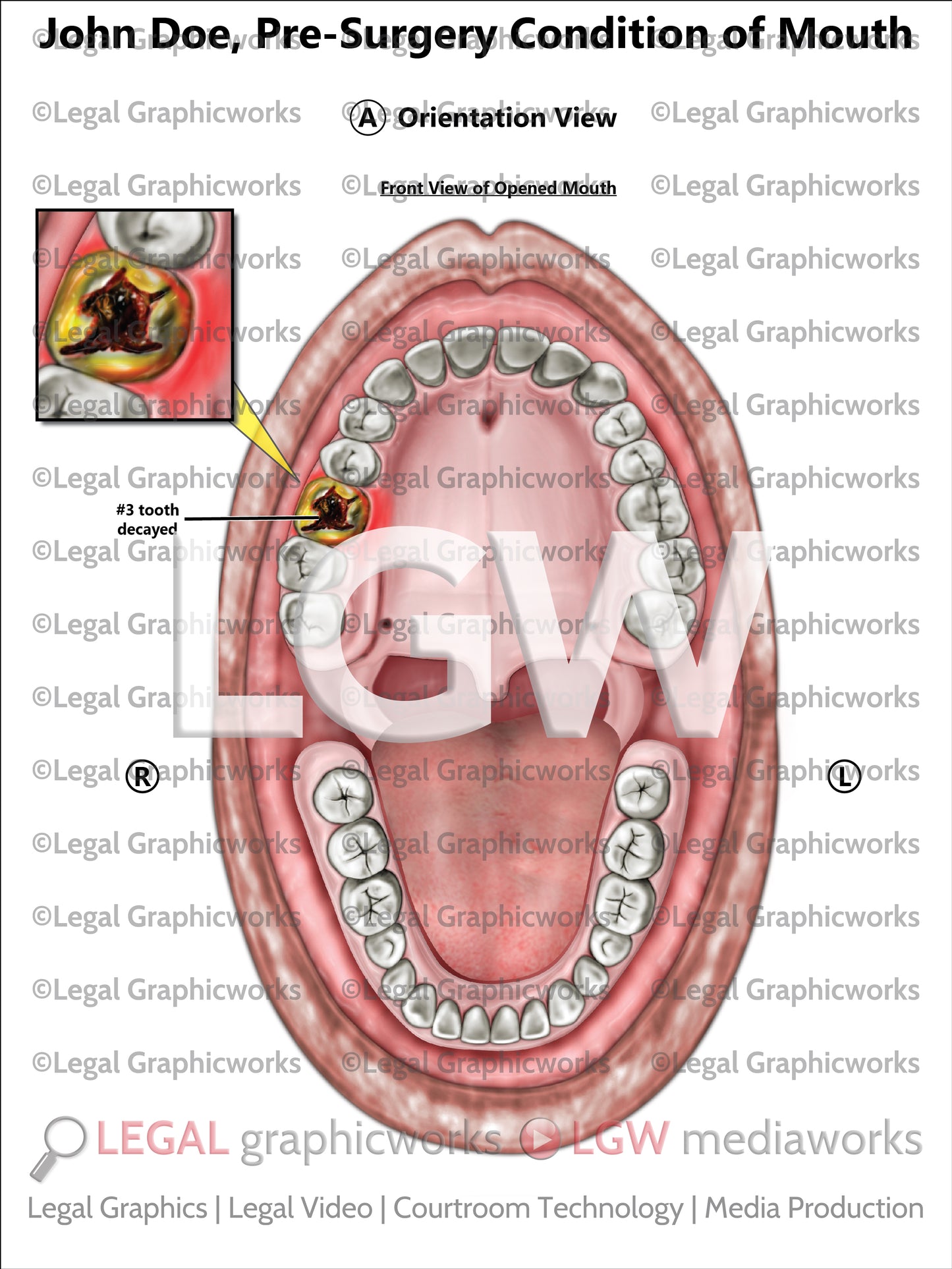 Pre-Surgery Condition of Mouth