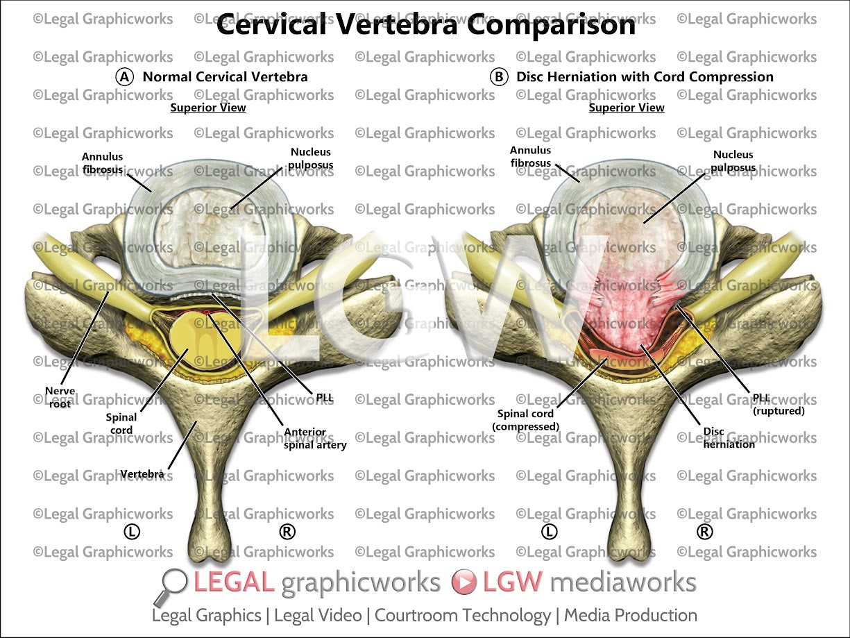 Cervical Vertebra Comparison