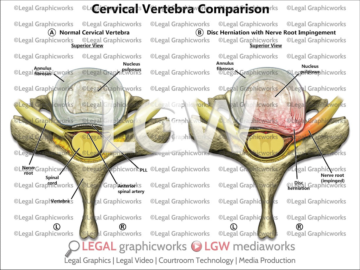 Cervical Vertebra Comparison