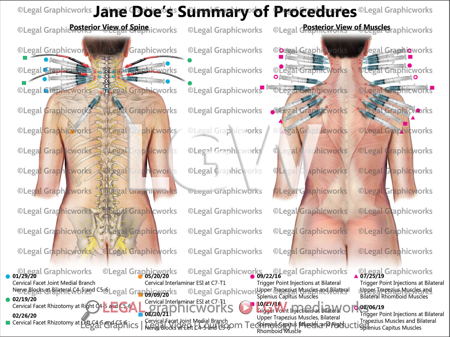 Summary of Procedures