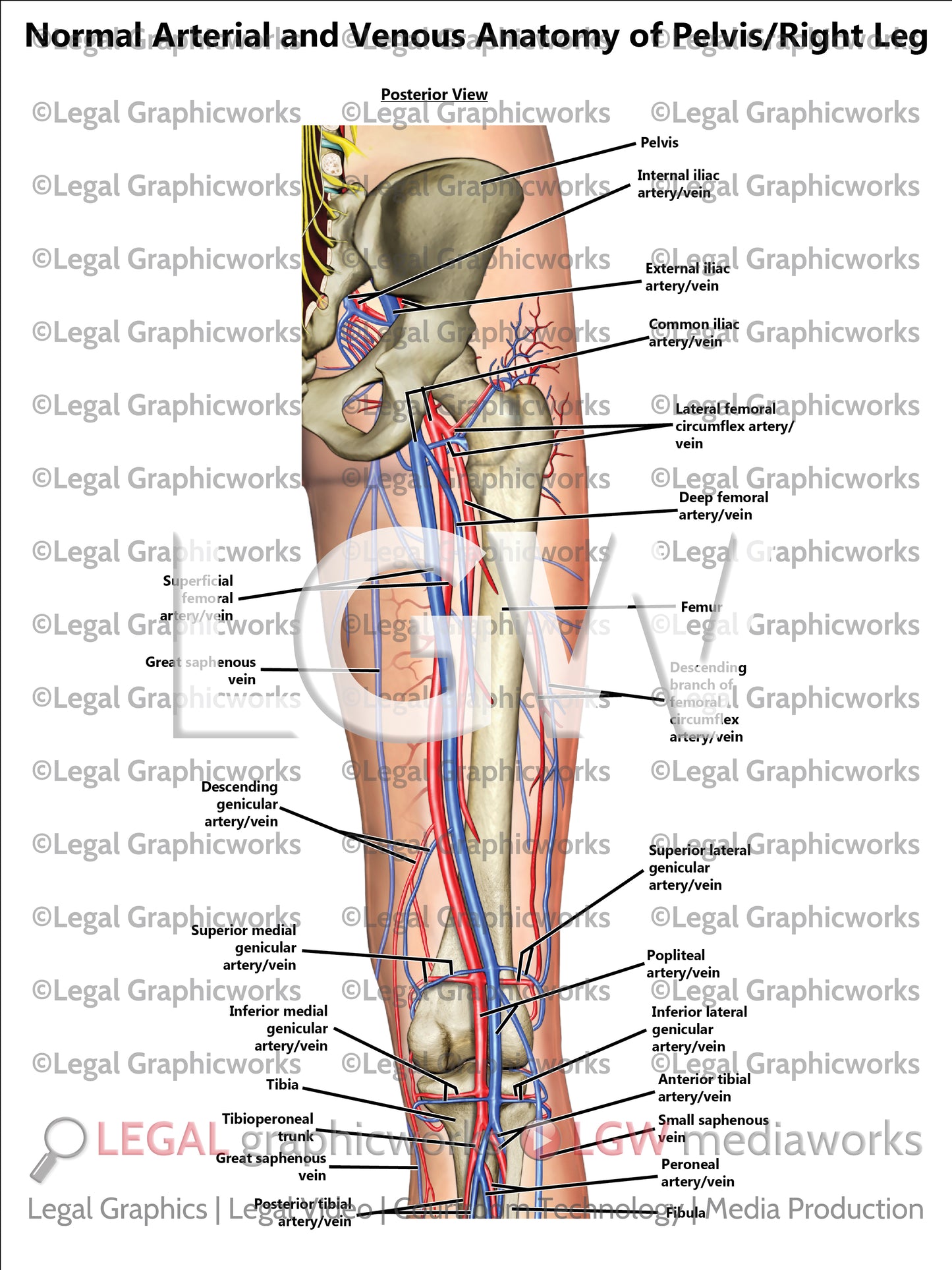 Normal Arterial and Venous Anatomy of Pelvis/Right Leg