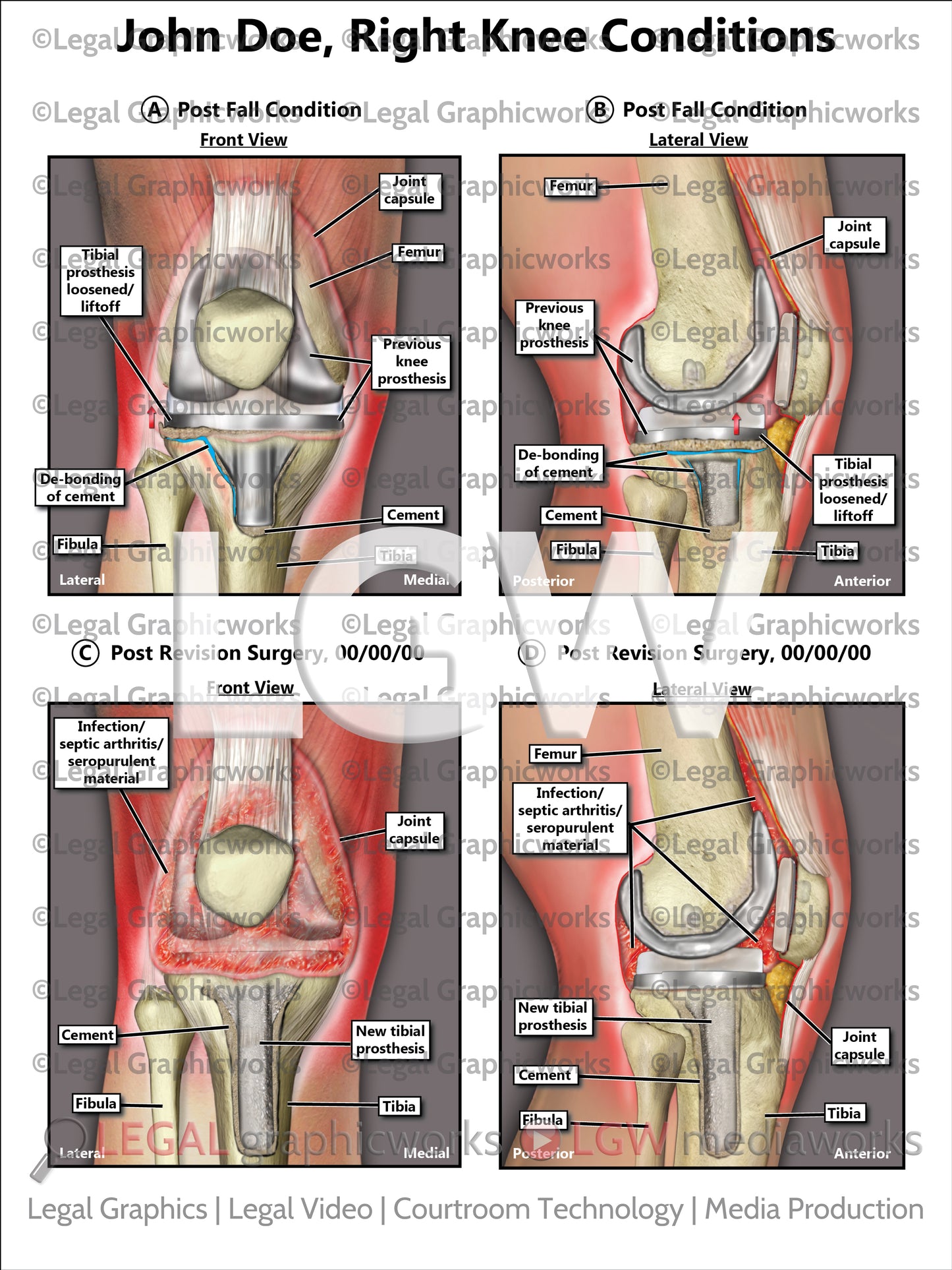 Right Knee Conditions
