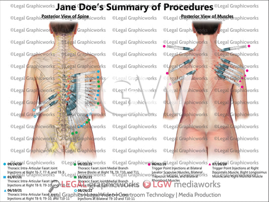 Summary of Procedures