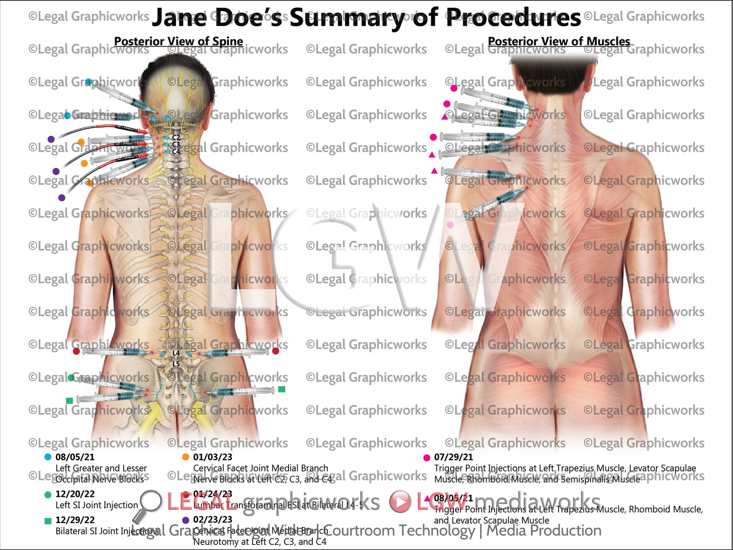 Summary of Procedures