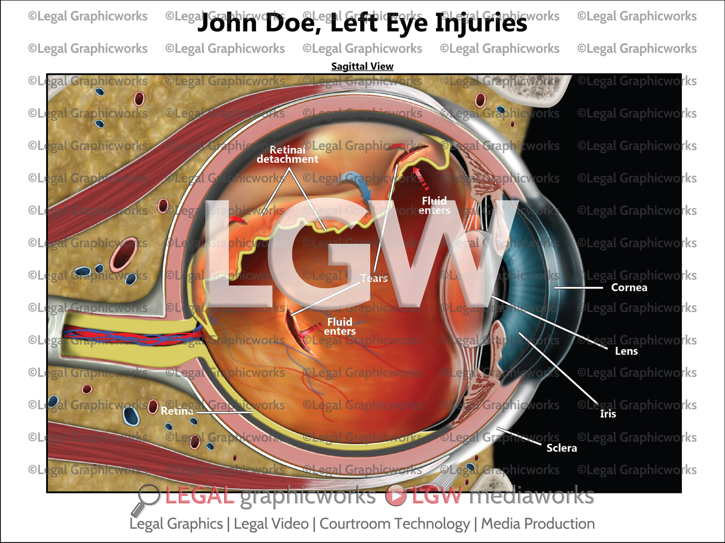 Left Eye Injuries