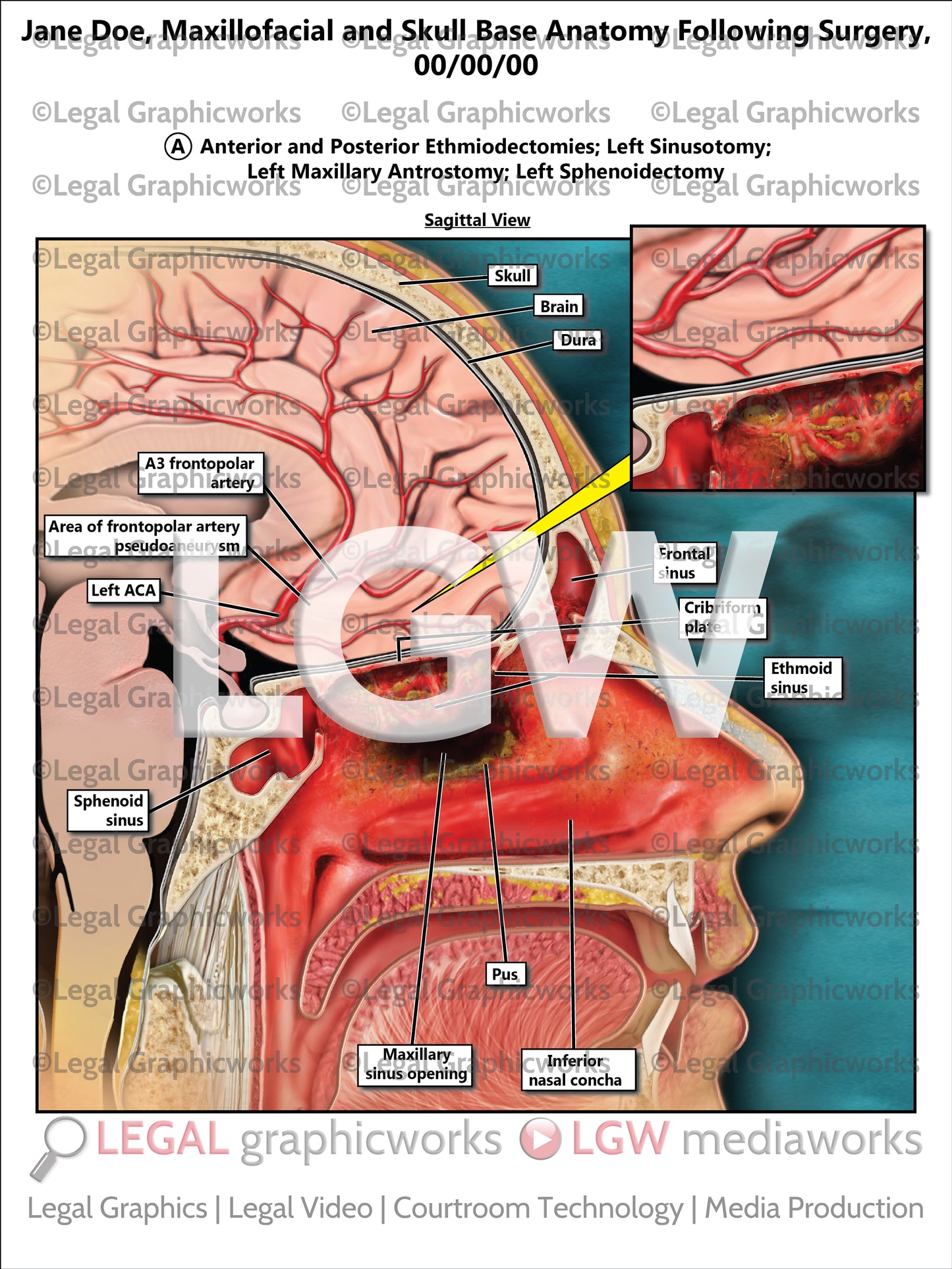 Maxillofacial and Skull Base Anatomy Following Surgery