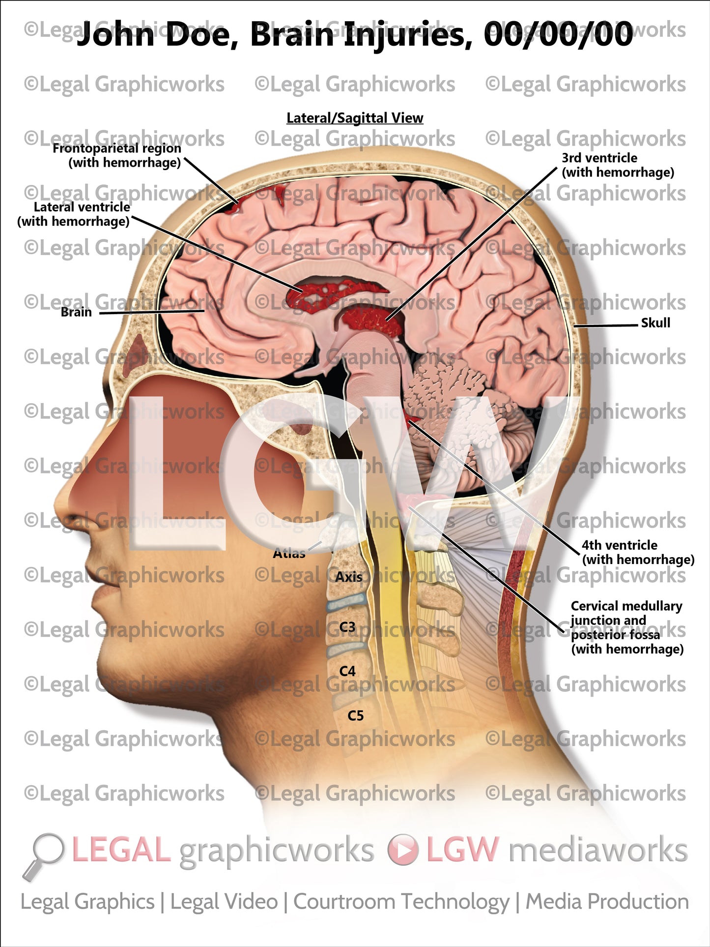 Brain Injuries