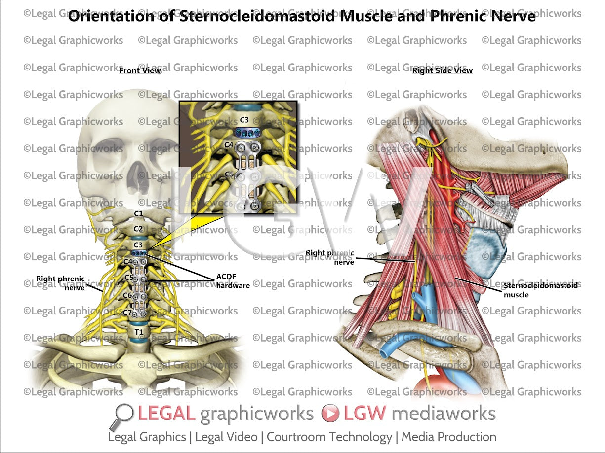Orientation of Sternocleidomastoid Muscle and Phrenic Nerve