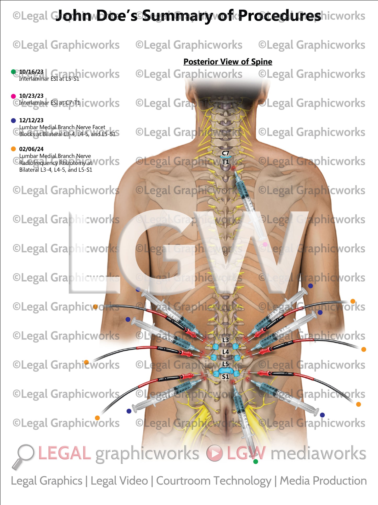 Summary of Procedures