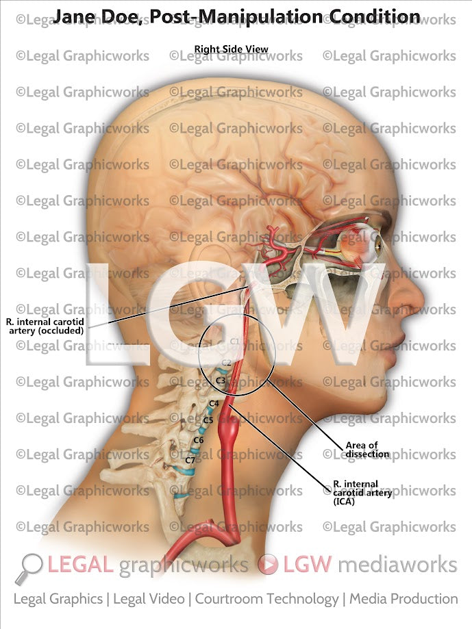 Post-Manipulation Condition
