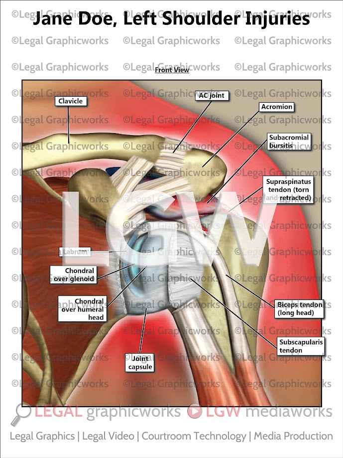 Left Shoulder Injuries