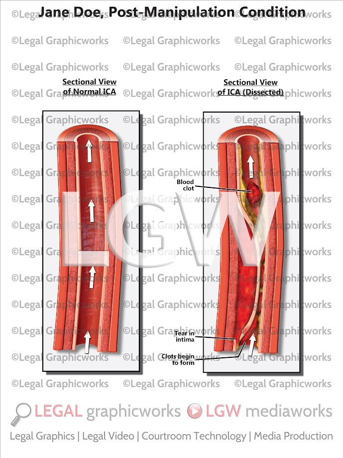 Post-Manipulation Condition