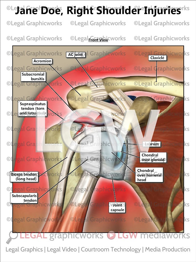 Right Shoulder Injuries
