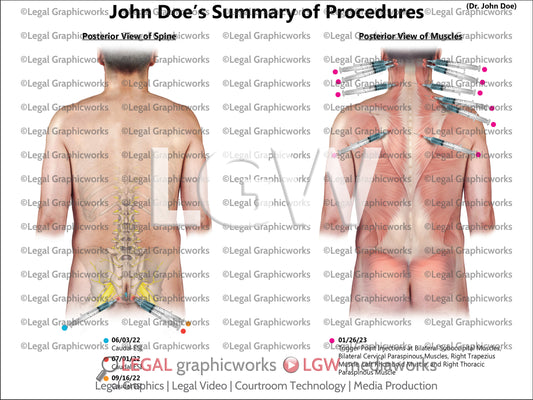 Summary of Procedures