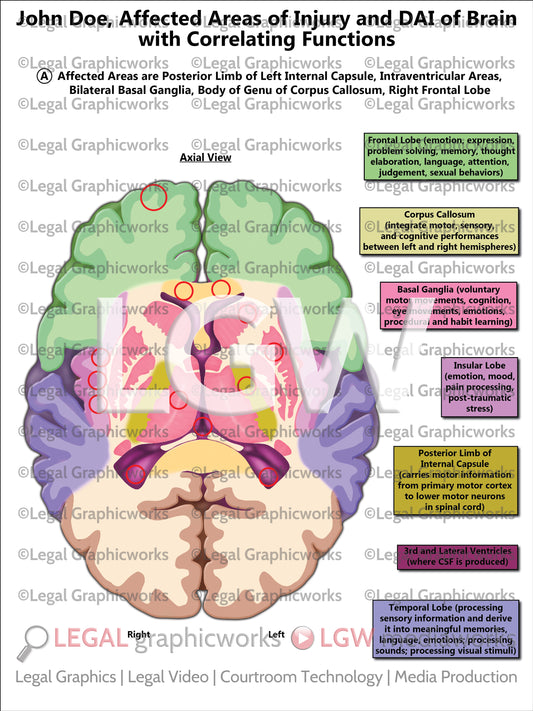 Affected Areas of Injury and DAI of Brain with Correlating Functions