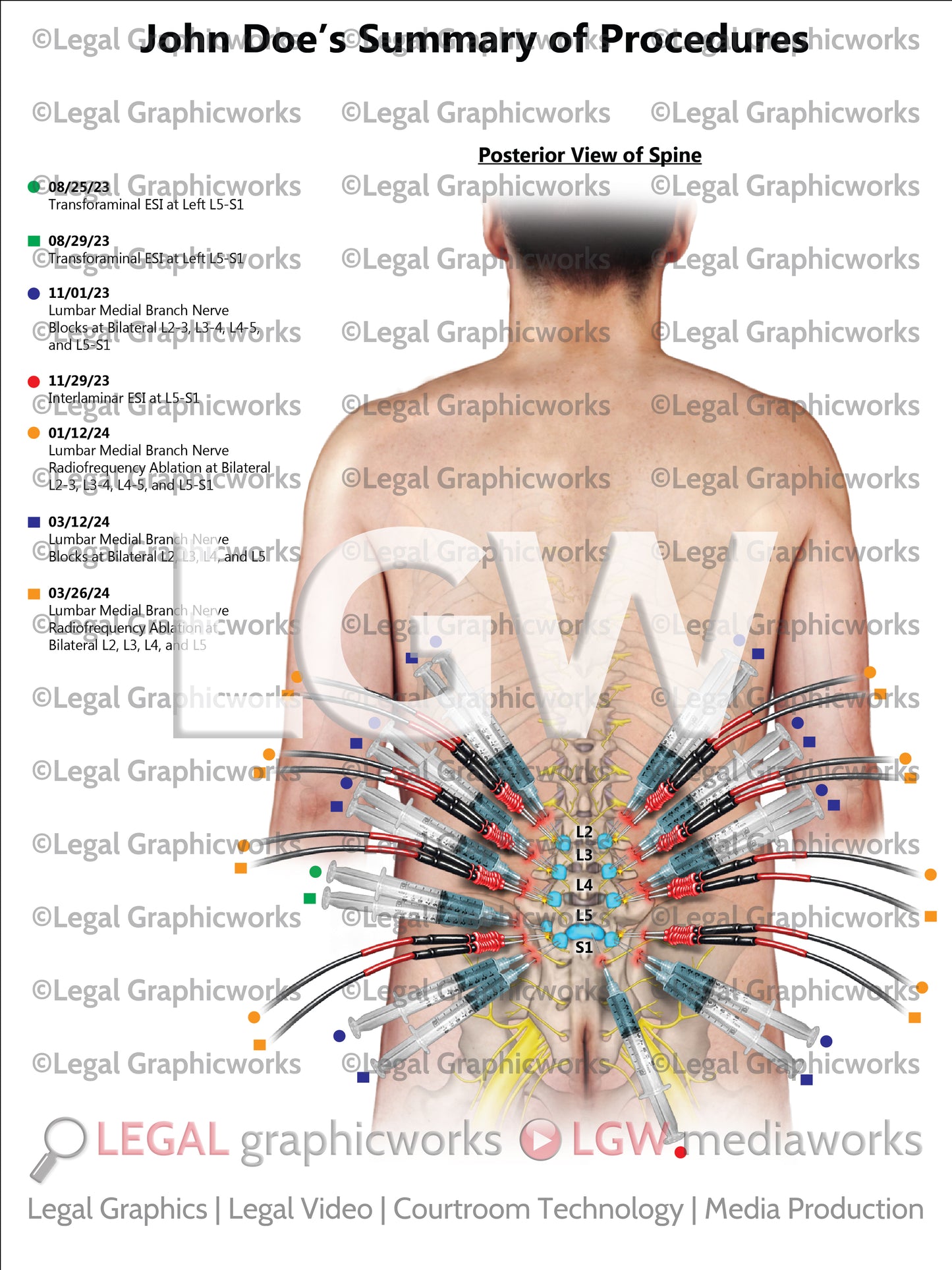 Summary of Procedures